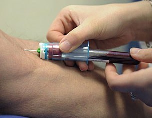 needle_305px.jpg needle_305px.jpg