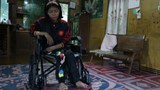 လက်နက်ကြီးကြောင့် မသန်စွမ်းဖြစ်ပြီး အနာဂတ်ပျောက်ခဲ့ရတဲ့ ကချင်အမျိုးသမီးငယ်