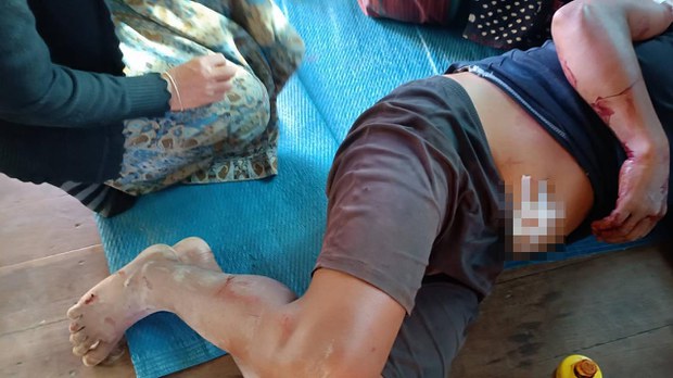ကယားနဲ့ ရှမ်းမှာ လေကြောင်းနဲ့ လက်နက်ကြီးကြောင့် သုံးရက်အတွင်း အရပ်သားနှစ်ဆယ်သေဆုံး ကယားနဲ့ ရှမ်းမှာ လေကြောင်းနဲ့ လက်နက်ကြီးကြောင့် သုံးရက်အတွင်း အရပ်သားနှစ်ဆယ်သေဆုံး
