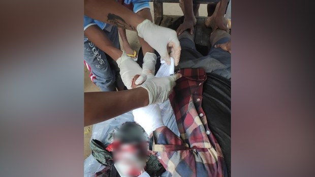 ဘုတလင်မှာ စစ်ကောင်စီရဲ့ လက်နက်ကြီးကြောင့် PDF နှစ်ဦးနဲ့ အဘွားအိုတစ်ဦးသေဆုံး