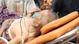 ဒီးမော့ဆိုမှာ လက်နက်ကြီးကြောင့် ဒေသခံနှစ်ဦးသေဆုံးပြီး လေးဦးဒဏ်ရာရ
