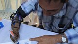 hand-disable-620.jpg