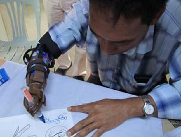 hand-disable-620.jpg hand-disable-620.jpg