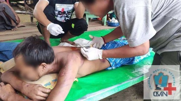 ကနီမှာ စစ်တပ်ရဲ့ နှိပ်စက်မှုကြောင့် တစ်ဦးသေဆုံး၊ ၁၄ ဦး ဒဏ်ရာရ ကနီမှာ စစ်တပ်ရဲ့ နှိပ်စက်မှုကြောင့် တစ်ဦးသေဆုံး၊ ၁၄ ဦး ဒဏ်ရာရ