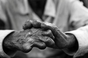 leprosy-305 leprosy-305