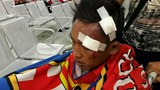 myanmar-fan-injure-622.jpg