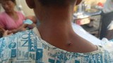 oakpho-injure-622.jpg