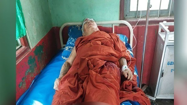 မူဆယ်မြို့နယ်က တိုက်ပွဲတွေအတွင်း ရဟန်းတစ်ပါးနဲ့ အရပ်သားတချို့ ဒဏ်ရာရ မူဆယ်မြို့နယ်က တိုက်ပွဲတွေအတွင်း ရဟန်းတစ်ပါးနဲ့ အရပ်သားတချို့ ဒဏ်ရာရ