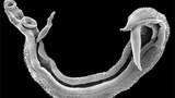schistosomes-622.jpg