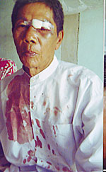 than_lwin_150px.jpg than_lwin_150px.jpg