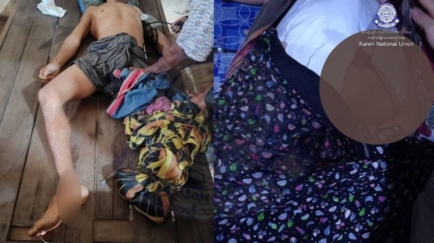 ရွှေကျင်မှာ လက်နက်ကြီးကြောင့် နှစ်ဦးသေ၊ ငါးဦးဒဏ်ရာရ ရွှေကျင်မှာ လက်နက်ကြီးကြောင့် နှစ်ဦးသေ၊ ငါးဦးဒဏ်ရာရ