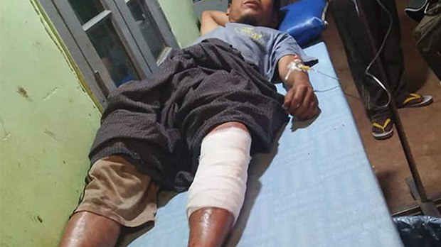 villager-injure-622.jpg villager-injure-622.jpg