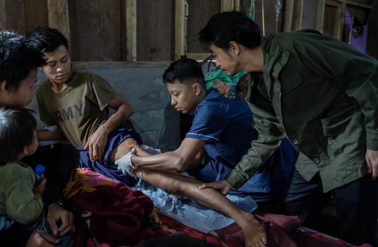 ၂၀၂၁ ခုနှစ် စစ်အာဏာသိမ်းမှုဆန့်ကျင်ရေးဆန္ဒပြပွဲတွင် စစ်ကောင်စီတပ်၏ပစ်ခတ်မှုကြောင့် ဒဏ်ရာရခဲ့သည့်  စောသိန်းဝင်း၏ ဒဏ်ရာဟောင်းကို ကယားပြည်နယ် ဒီးမော့ဆိုမြို့နယ်ရှိ အိုဝမ်း (O-1) ဆေးရုံတွင် ဒေါက်တာအောင်ကိုမြင့်နှင့် ဒေါက်တာယိုရီတို့ စစ်ဆေးကုသပေးနေသည်ကို ၂၀၂၄ ခုနှစ် နိုဝင်ဘာ ၆ ရက်နေ့က တွေ့ရစဉ်။ (Gemunu Amarasinghe/RFA)