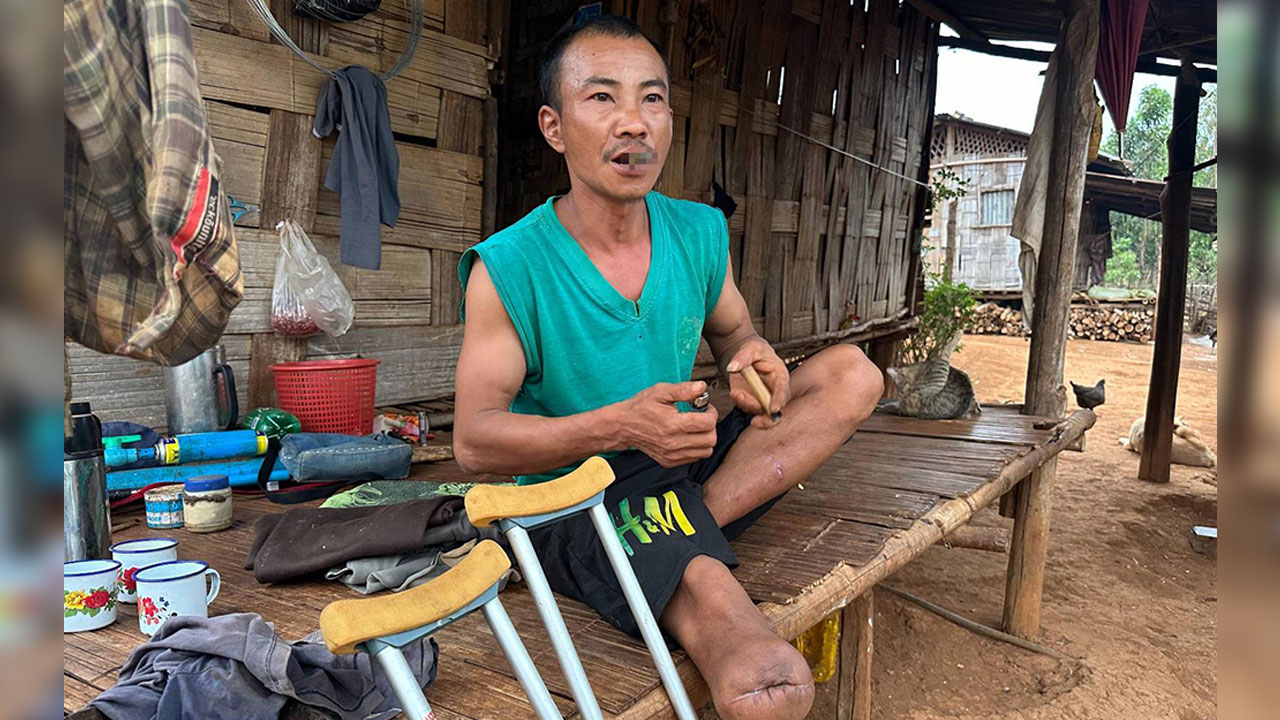 မြေမြှုပ်မိုင်းကြောင့် ကိုယ်လက်အင်္ဂါထိခိုက်ခဲ့ရသည့် ရှမ်းပြည်နယ်မြောက်ပိုင်း၊ နမ္မတူမြို့ခံတစ်ဦးကို ၂၀၂၄ ခုနှစ် မတ်လ ၂၇ ရက်နေ့က တွေ့ရစဉ်။ (Photo: RFA)