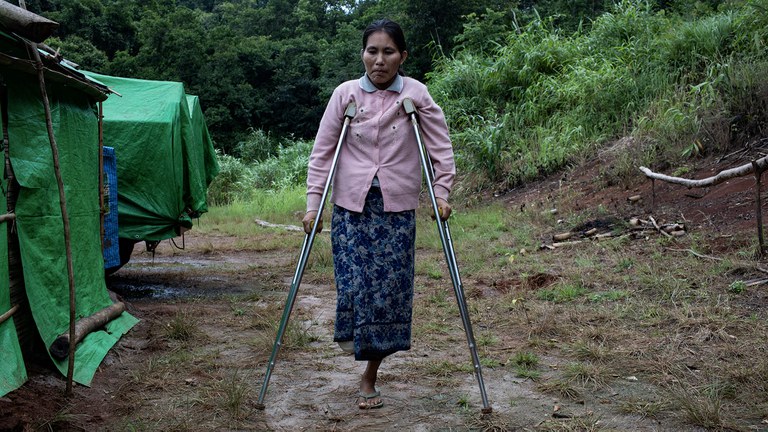 ဖယ်ခုံမြို့နယ်အနီးရှိ စစ်ဘေး ဒုက္ခသည်စခန်းတွင် မြေမြှုပ်မိုင်းကြောင့် ခြေထောက်တစ်ဖက် ဆုံးရှုံးလိုက်ရသည့် မလှဝင်းအား ၂ဝ၂၃ ခုနှစ် ဇူလိုင်လ ၂၉ ရက်နေ့တွင် တွေ့ရစဉ်။   (Photo : AFP)