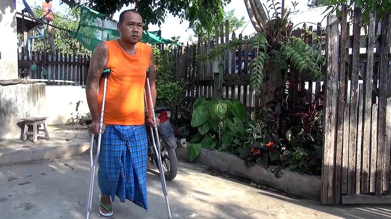 သီပေါမြို့တွင် ၂၀၂၂ ခုနှစ် ဖေဖော်ဝါရီလ ၂၈ ရက်နေ့က မိုင်းနင်းမိပြီး ဘယ်ခြေတစ်ဖက် ဆုံးရှုံးလိုက်ရသည့် ကိုအိုက်ပီးအား  တွေ့ရစဥ်။ (Photo: RFA)