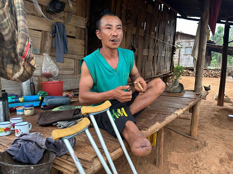 မြေမြှုပ်မိုင်းကြောင့် ထိခိုက်ဒဏ်ရာရသူတစ်ဦးကို ၂၀၂၄ ခုနှစ် မတ်လ ၂၇ ရက်နေ့က တွေ့ရစဉ်။ (Photo: RFA)