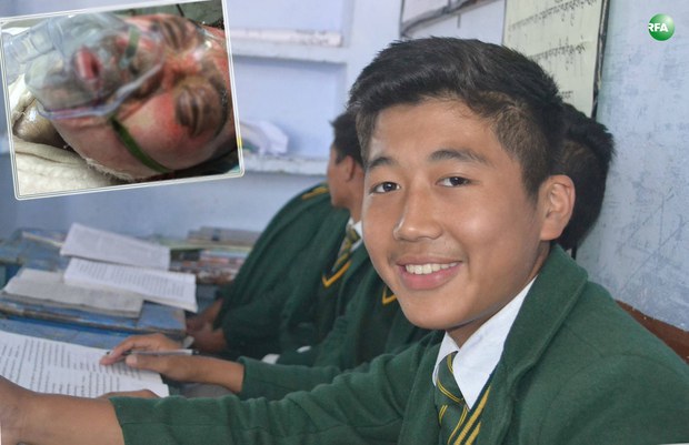 རང་ལུས་མེར་བསྲེགས་གནས་མཁན་སློབ་ཕྲུག་རྡོ་རྗེ་ཚེ་རིང་གི་ཉེ་པར་དང་སྨན་ཁང་ནང་གི་པར། ༢༠༡༦ རང་ལུས་མེར་བསྲེགས་གནས་མཁན་སློབ་ཕྲུག་རྡོ་རྗེ་ཚེ་རིང་གི་ཉེ་པར་དང་སྨན་ཁང་ནང་གི་པར། ༢༠༡༦