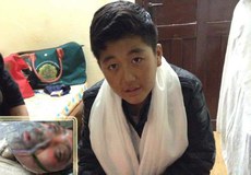 རང་ལུས་མེར་བསྲེགས་གནས་མཁན་སློབ་ཕྲུག་རྡོ་རྗེ་ཚེ་རིང་གི་ཉེ་པར་དང་སྨན་ཁང་ནང་གི་པར། ༢༠༡༦