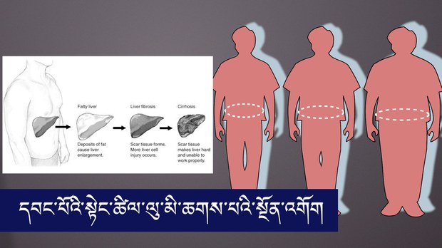དབང་པོའི་སྟེང་ཚིལ་ལུ་མི་ཆགས་པའི་སྔོན་འགོག