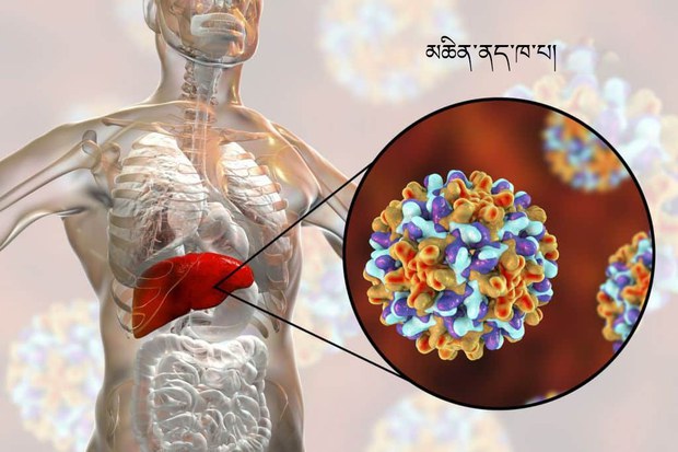 མཆིན་ནད་ཁ་པར་དོ་སྣང་དང་སྔོན་འགོག་བྱ་ཕྱོགས།